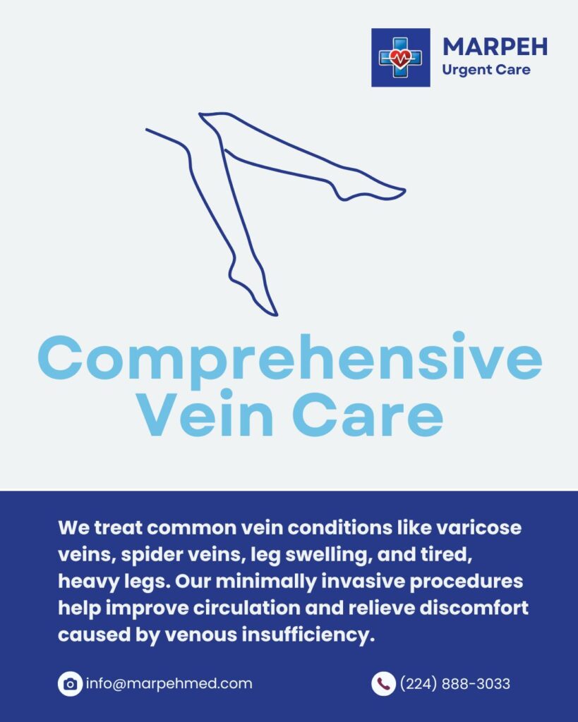 Comprehensive vein care illustration showing treatment for varicose veins, spider veins, and leg swelling at Generation Vein Clinic, part of Marpeh Urgent Care in Niles, IL