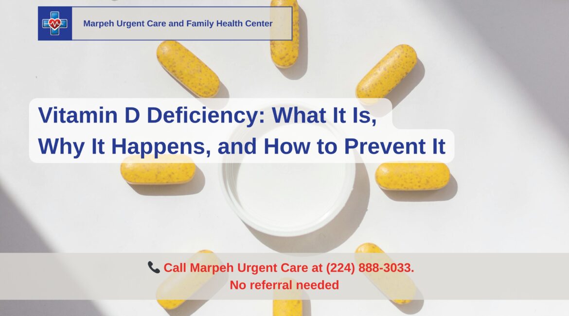 Vitamin D supplements, healthy foods like salmon and eggs, and sunlight exposure