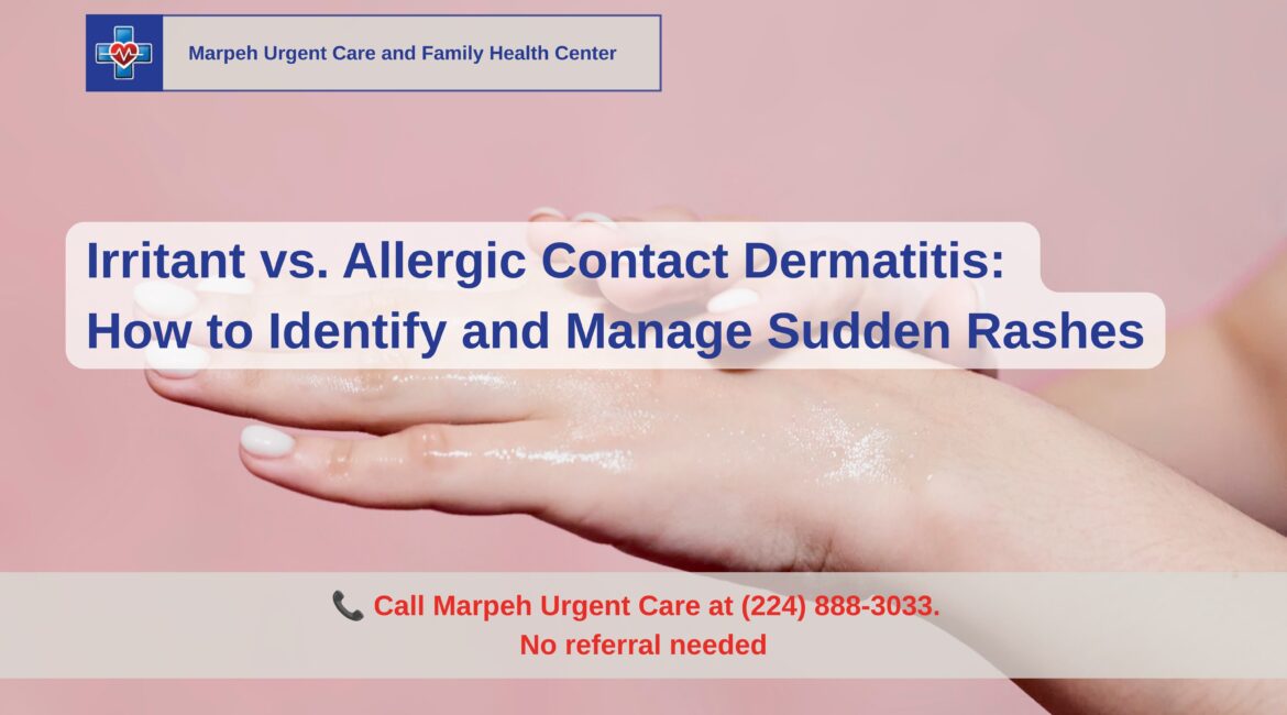 Irritant vs. Allergic Contact Dermatitis: How to Identify and Manage Sudden Rashes
