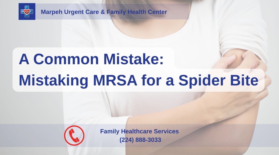 MRSA Skin Infection Symptoms and Evaluation